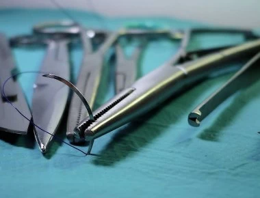 Πήγε στον γιατρό με πόνο στο αυτί - Δεν μπορούσε να φανταστεί τι υπήρχε μέσα της (φωτο)